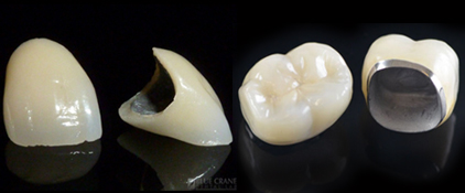 branded artificial tooth